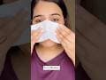 1 Day Remove Blackheads/Whiteheads, Glass Nose Skin #skincare #beauty #glassskin
