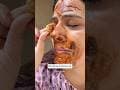 Blackheads/Whiteheads & Dead skin Remover in 1 Day, Get Glass Skin #beauty #skin