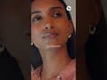 Lip Pigmentation | Lip Treatment | Urmila Nimbalkar